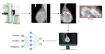 EEF-Net: An Enhanced EfficientNet for Breast Tumor Classification in Mammograms